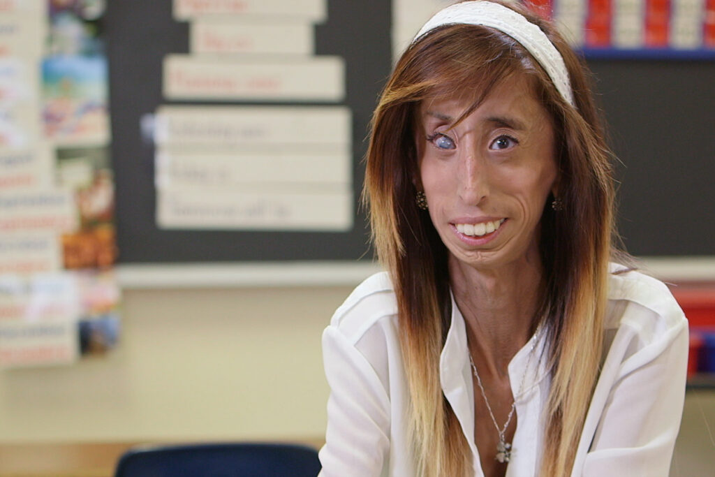 Lizzie Velasquez